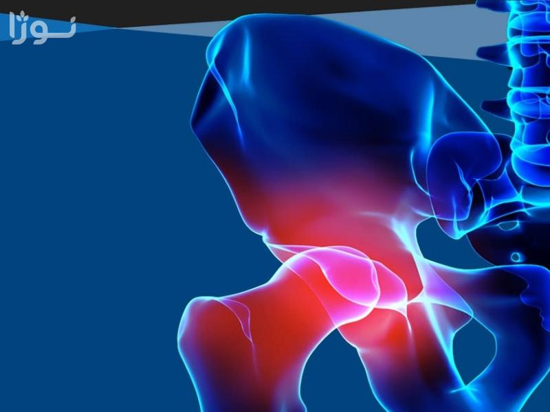 شکستگی لگن؛ علل، علائم، تشخیص و روشهای درمان
