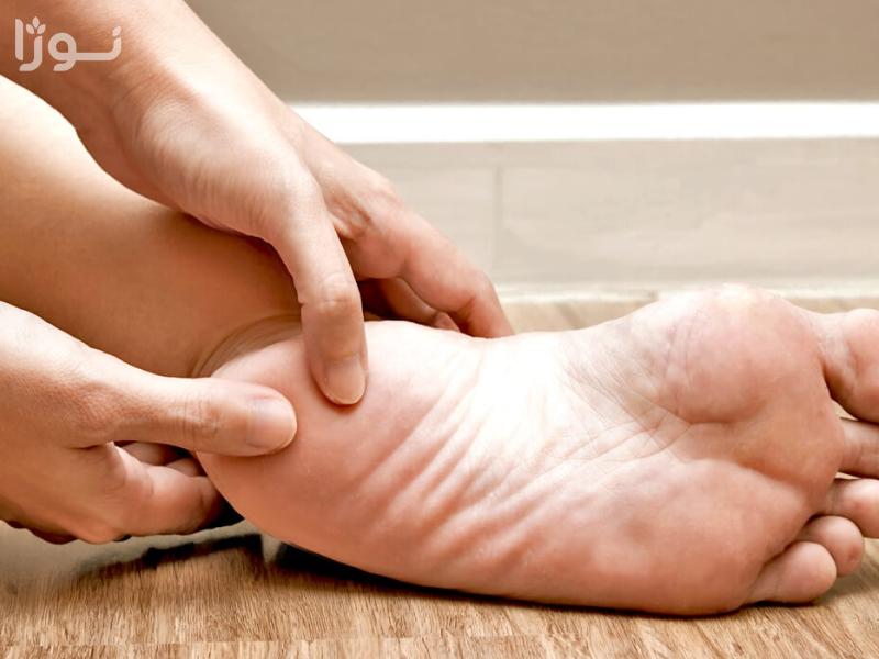  بهترین درمان زخم پای دیابتی برای کنترل عفونت
