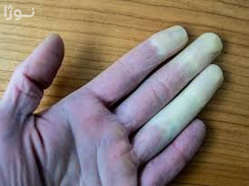 تصاویر وبلاگ خدمات جورسرویس