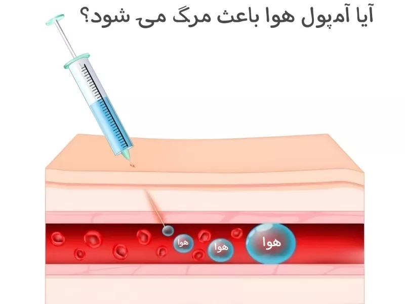 آیا تزریق هوا باعث مرگ میشود
