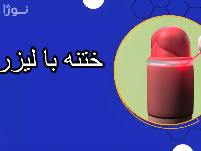 ختنه نوزاد با چه روشی بهتر است