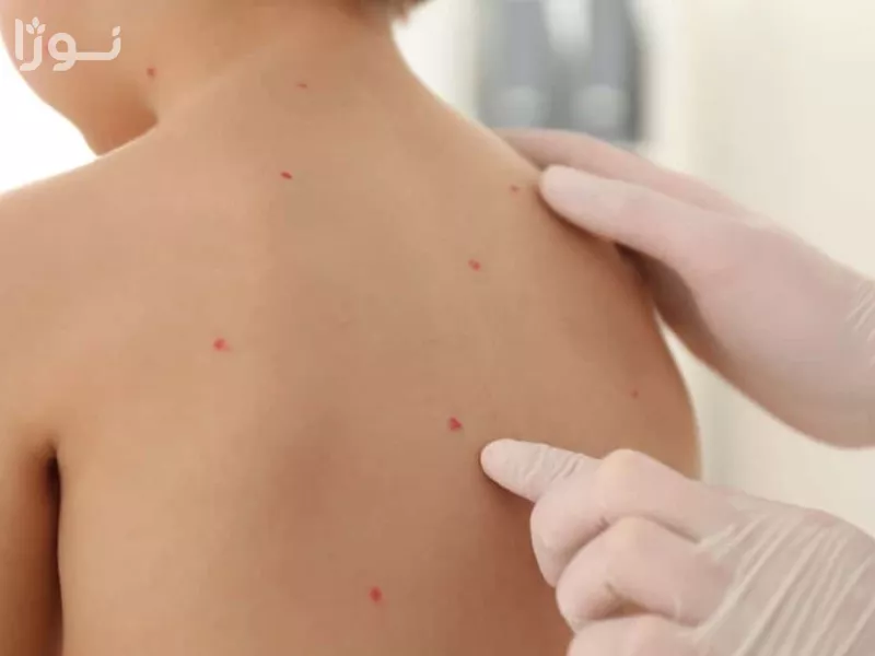تصاویر وبلاگ خدمات جورسرویس