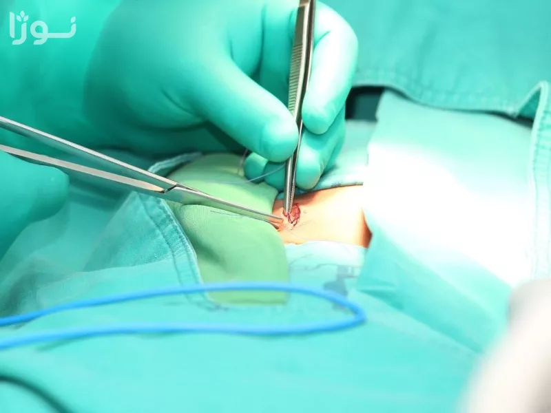 تصاویر وبلاگ خدمات جورسرویس