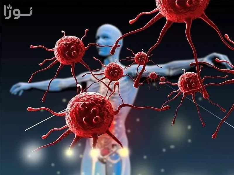 تصاویر وبلاگ خدمات جورسرویس