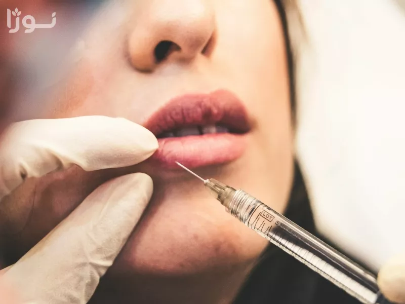 ورم بعد از تزریق ژل - خدمات زیبایی