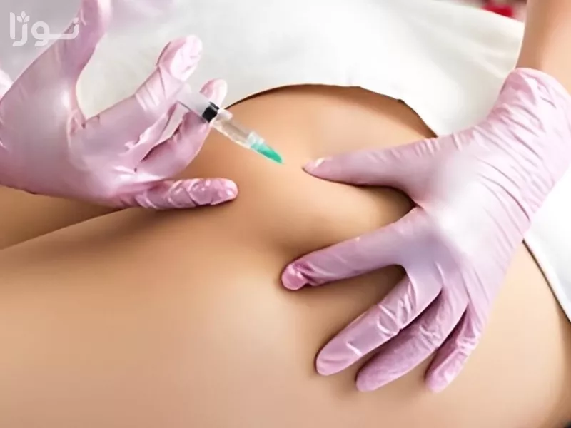 تصاویر وبلاگ خدمات جورسرویس