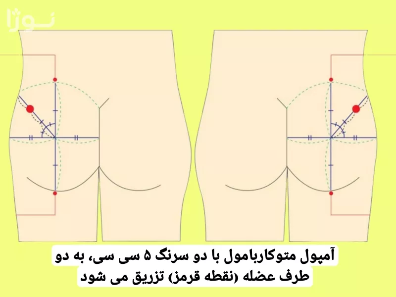 تصاویر وبلاگ خدمات جورسرویس