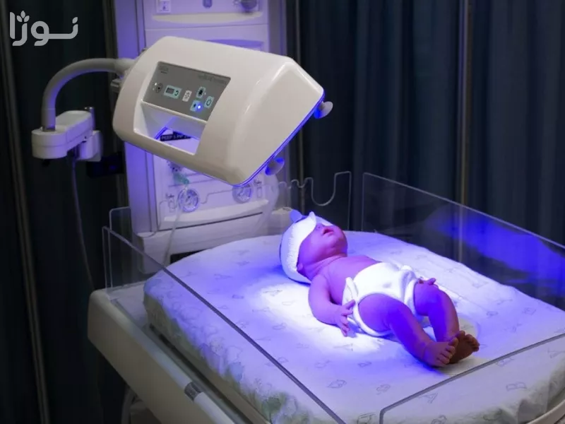 مدیریت عوارض جانبی دستگاه فتوتراپی نوزادان